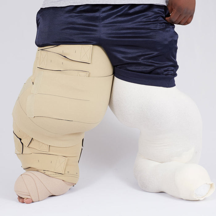 circaid reduction kit lobe